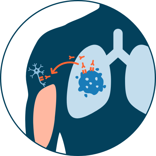 PARANEOPLASTIC SYNDROMES