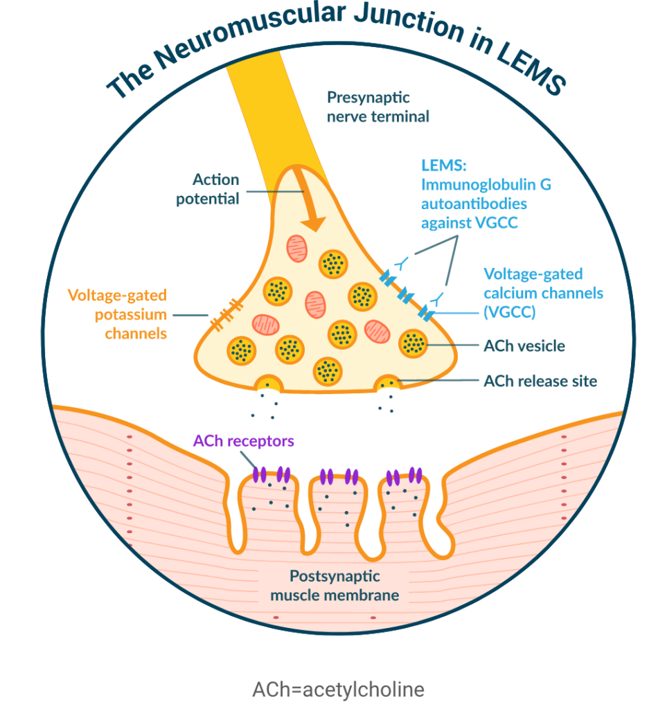 LEMS Diagram